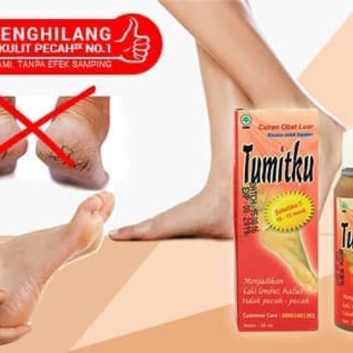 TUMITKU MENGATASI KAKI PECAH/KAPALAN tum...